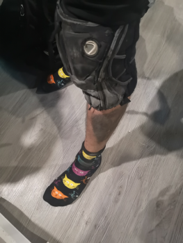 mein verdrecktes Bein mit Katzensocken